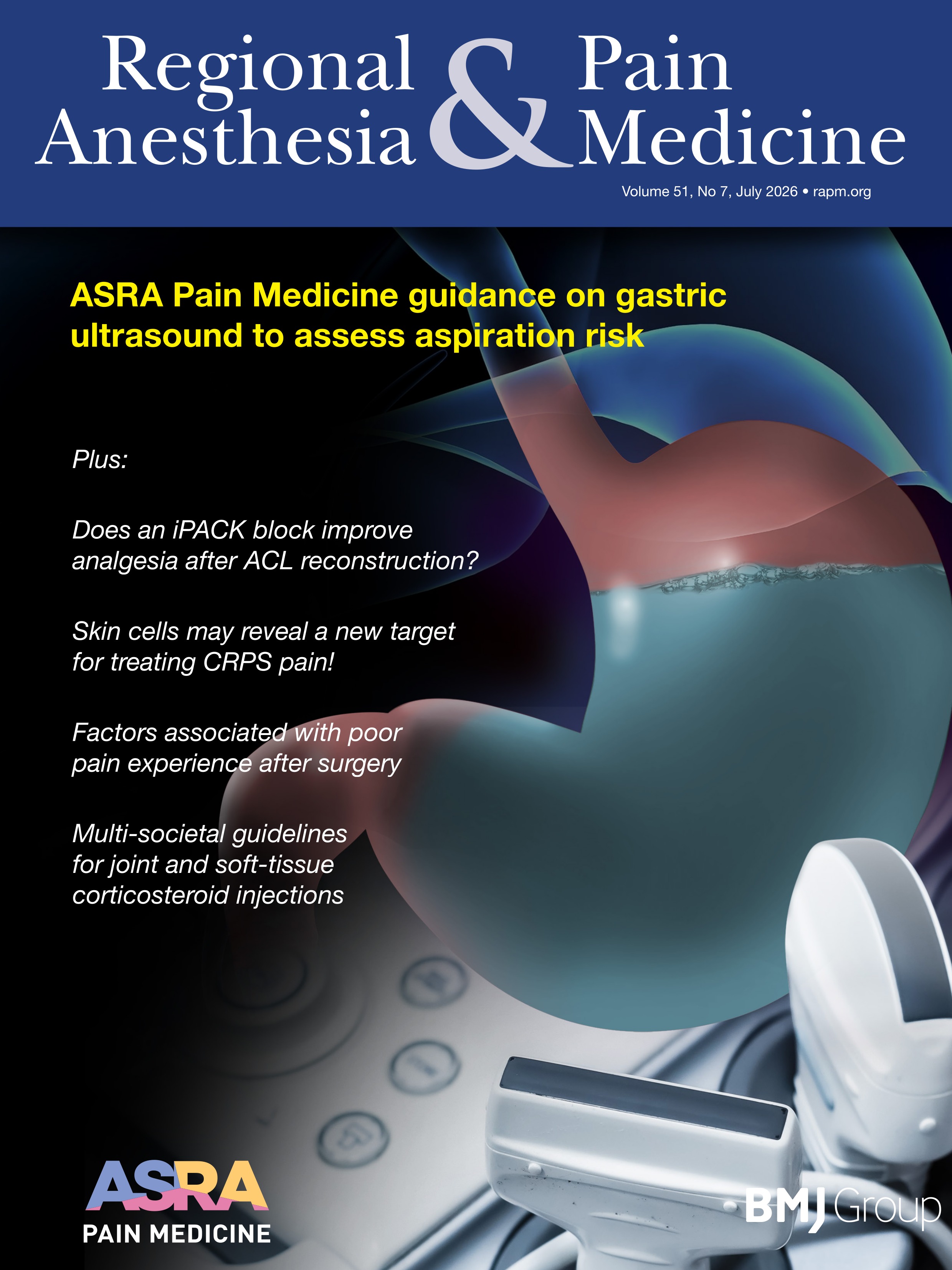 Critical exposure length for nerve block of myelinated fibers with